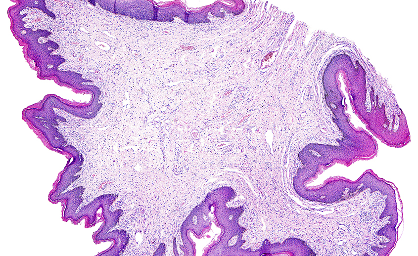 Imagen de una biopsia